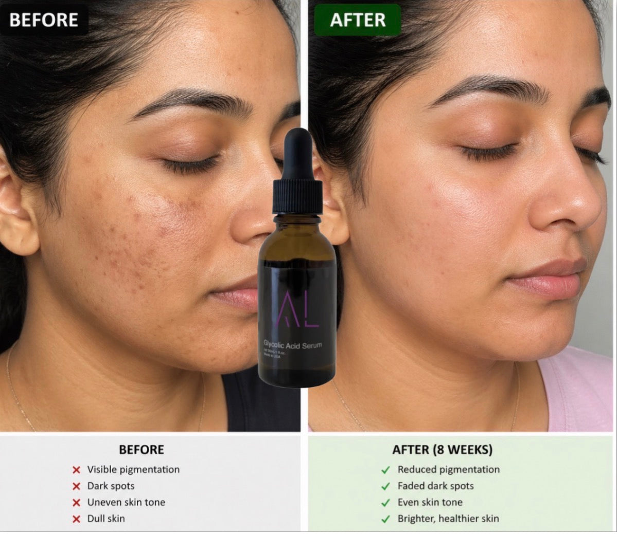 Glycolic Acid Serum